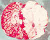 brain 34.jpg (21360 bytes)