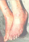 skin-3.jpg (26596 bytes)