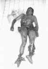 injury-14.jpg (77592 bytes)