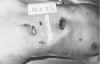 stab-5.jpg (64800 bytes)