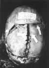skull-7.jpg (102092 bytes)